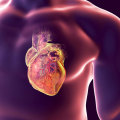 Possible Increased Risk of Heart Disease When Using Testosterone Replacement Therapy