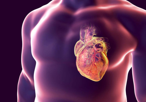 Possible Increased Risk of Heart Disease When Using Testosterone Replacement Therapy